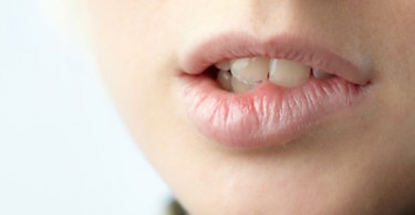 Find Natural Remedies For Dry Mouth At Night Find Natural Remedies For Dry Mouth At Night