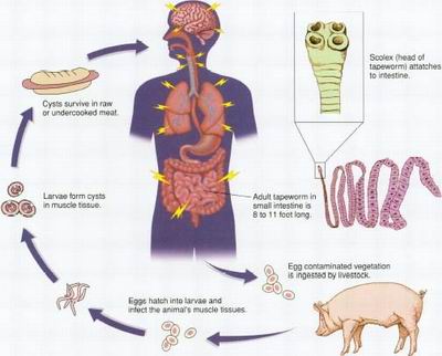 Tapeworm Infection Causes, Symptoms, Diagnosis and ...