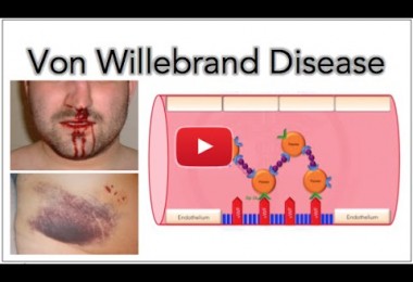 Natural Treatment For Von Willebrand Disease Natural Treatment For Von Willebrand Disease