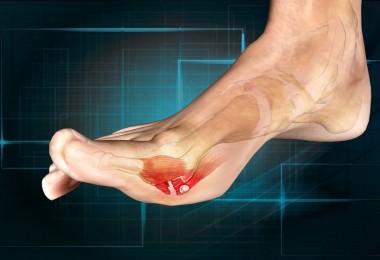 Natural Treatment For Turf Toe Natural Treatment For Turf Toe