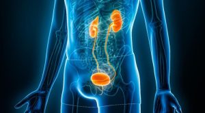 Bladder Cancer