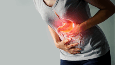 Gastroparesis