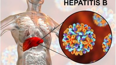 Hepatitis B
