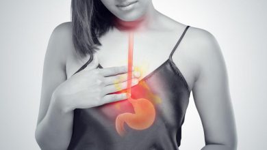 Heartburn