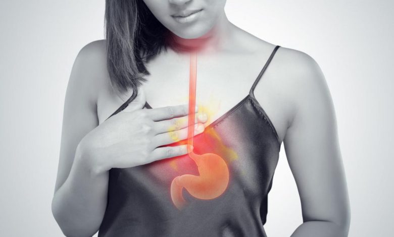 Heartburn