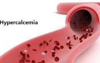 Hypercalcemia