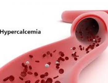Hypercalcemia