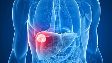 Liver Cancer