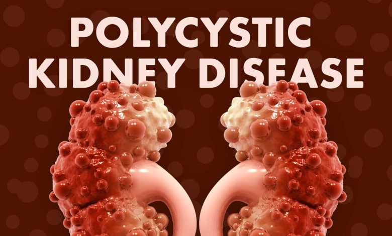 Polycystic Kidney Disease