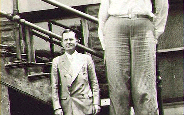Gigantism