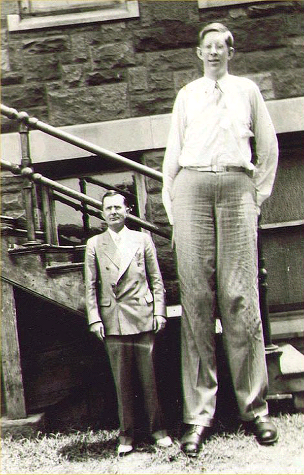 Gigantism