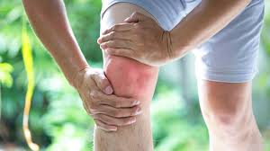 Septic Arthritis