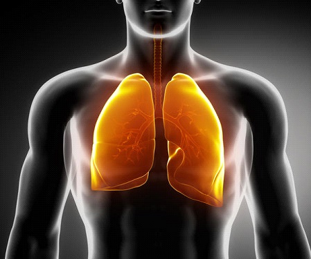 Acute Respiratory Distress Syndrome