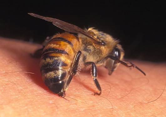 Bee Stings