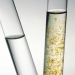 Cyclospora Infection
