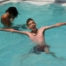 Marfan Syndrome