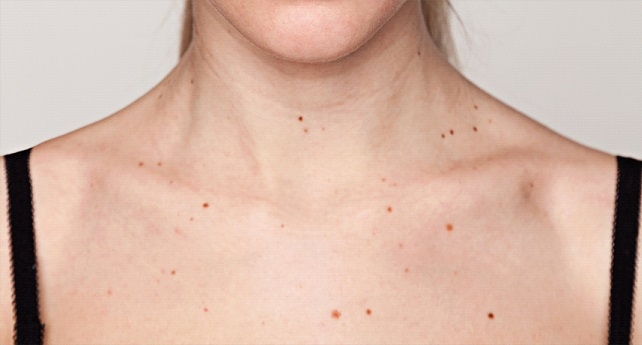 Moles