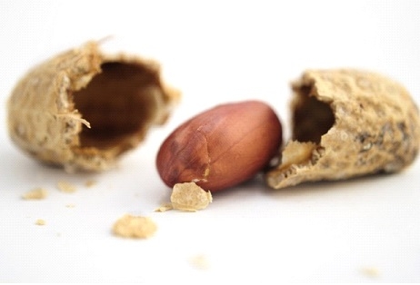 Peanut Allergy
