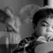 Hunter Syndrome