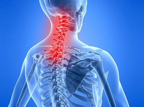 Neck Pain