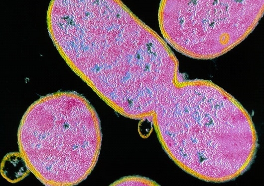 Shigella Infection