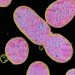 Shigella Infection