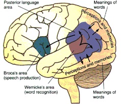 Aphasia