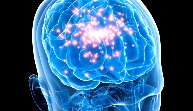 Epilepsy