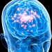 Epilepsy