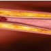 Cholesterol