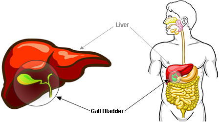 Gallbladder Disease