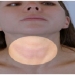 Thyroid