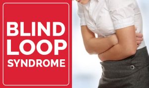 Blind Loop Syndrome