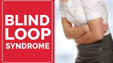 Blind Loop Syndrome