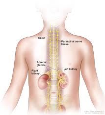 Neuroblastoma