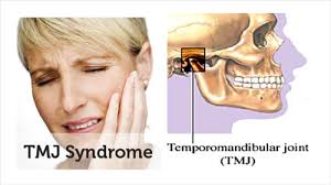 TMJ Disorder