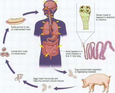 Tapeworm Infection Causes, Symptoms, Diagnosis and Treatment | Natural