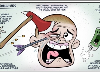 Cluster Headache