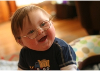 Down Syndrome