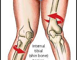 Cellulite causes and treatment Cellulite causes and treatment