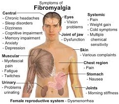 Fibromyalgia