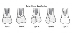 Growth Plate Fractures
