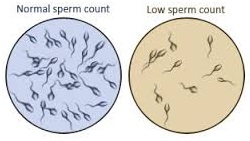 low-sperm-count