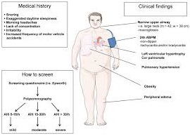 secondary-hypertension