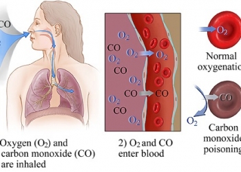 carbon-monoxide-poisoning