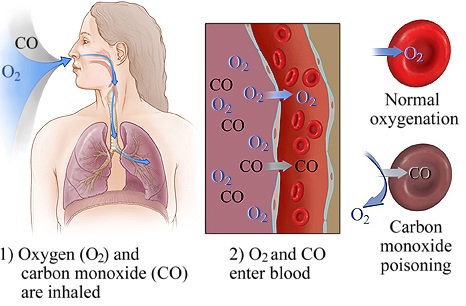 carbon-monoxide-poisoning