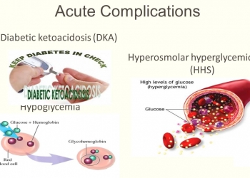 diabetic-hyperosmolar-syndrome