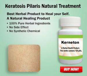 Keratosis Pilaris Natural Treatment