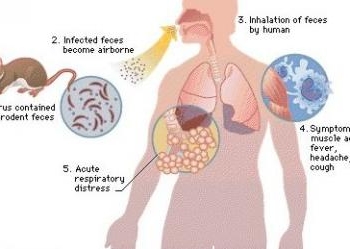 Hantavirus Pulmonary Syndrome