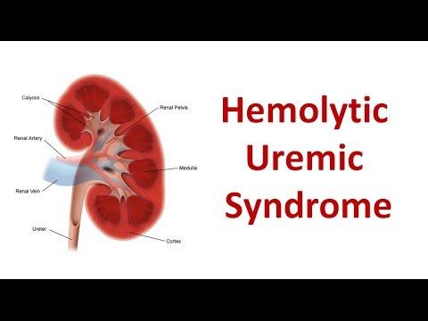 Hemolytic Uremic Syndrome